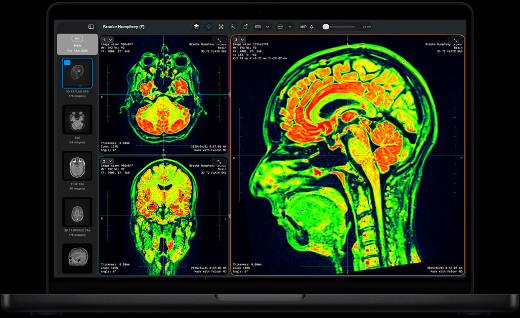 MacBook&nbsp;Pro ekrāns, kurā redzama Falcon&nbsp;MD aplikācija